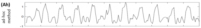 Multivariate Echtzeit-fMRT-Dekodierung_2.png