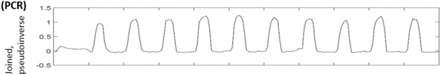 Multivariate Echtzeit-fMRT-Dekodierung_3.png